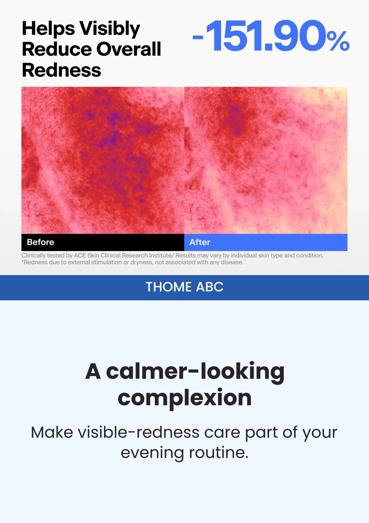 THOME ABC — Overall redness comparison