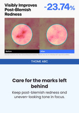 THOME ABC — Post-blemish redness comparison