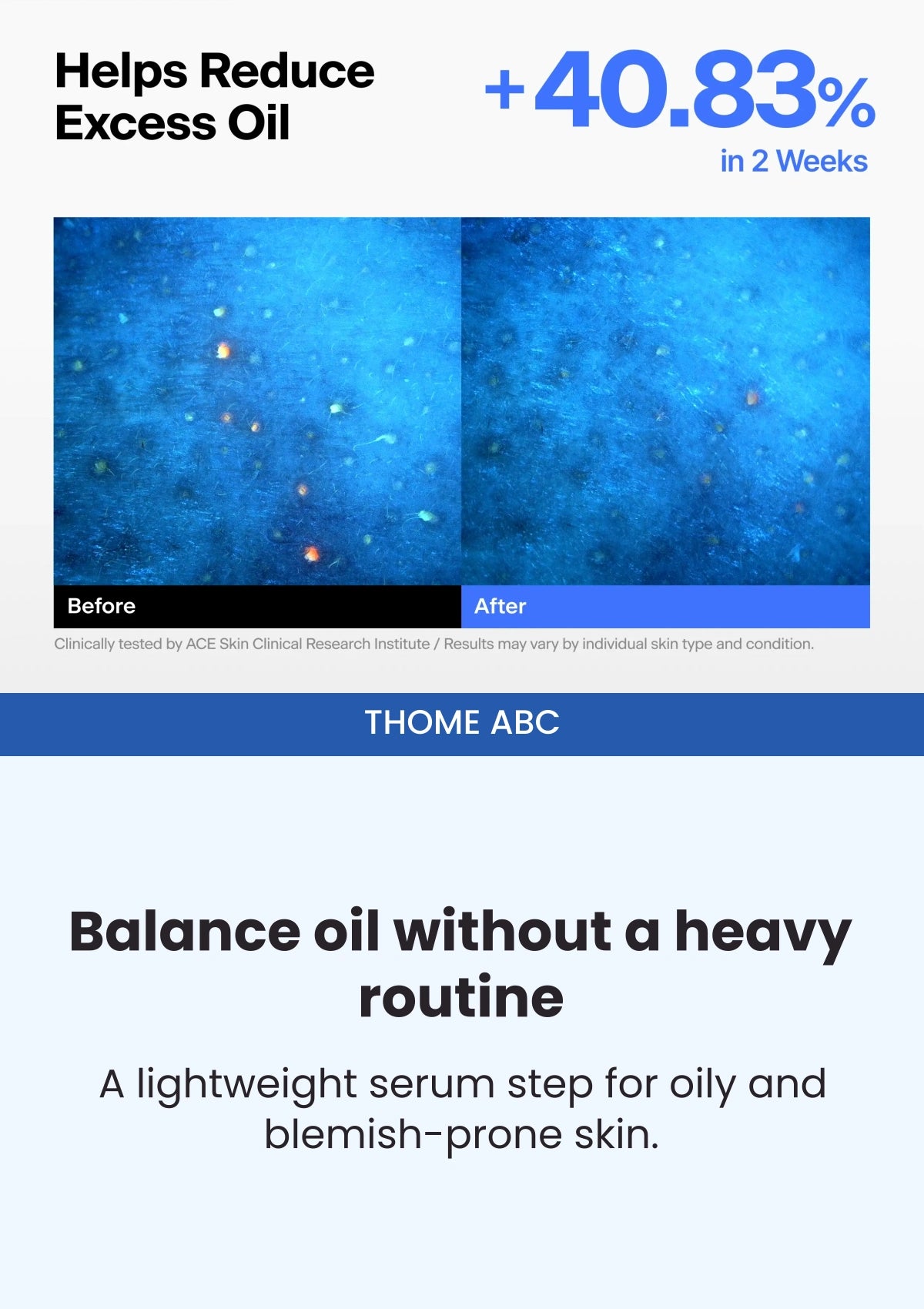 THOME ABC — Excess-oil comparison