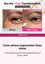 THOME CPR — Seven-day crow’s-feet transformation