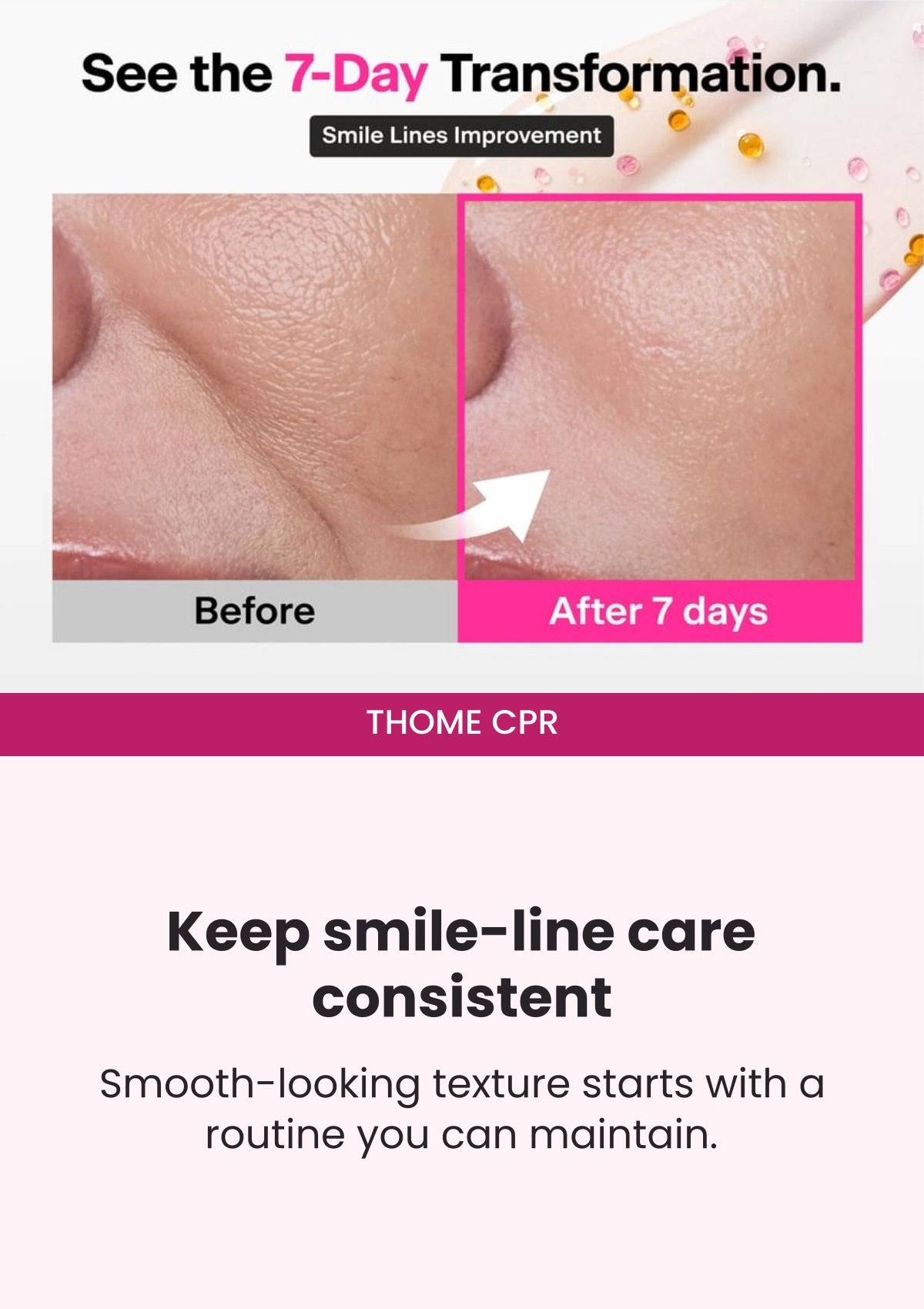 THOME CPR — Seven-day smile-line transformation