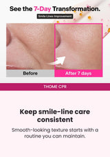 THOME CPR — Seven-day smile-line transformation