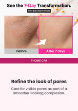 THOME CPR — Seven-day pore-size transformation