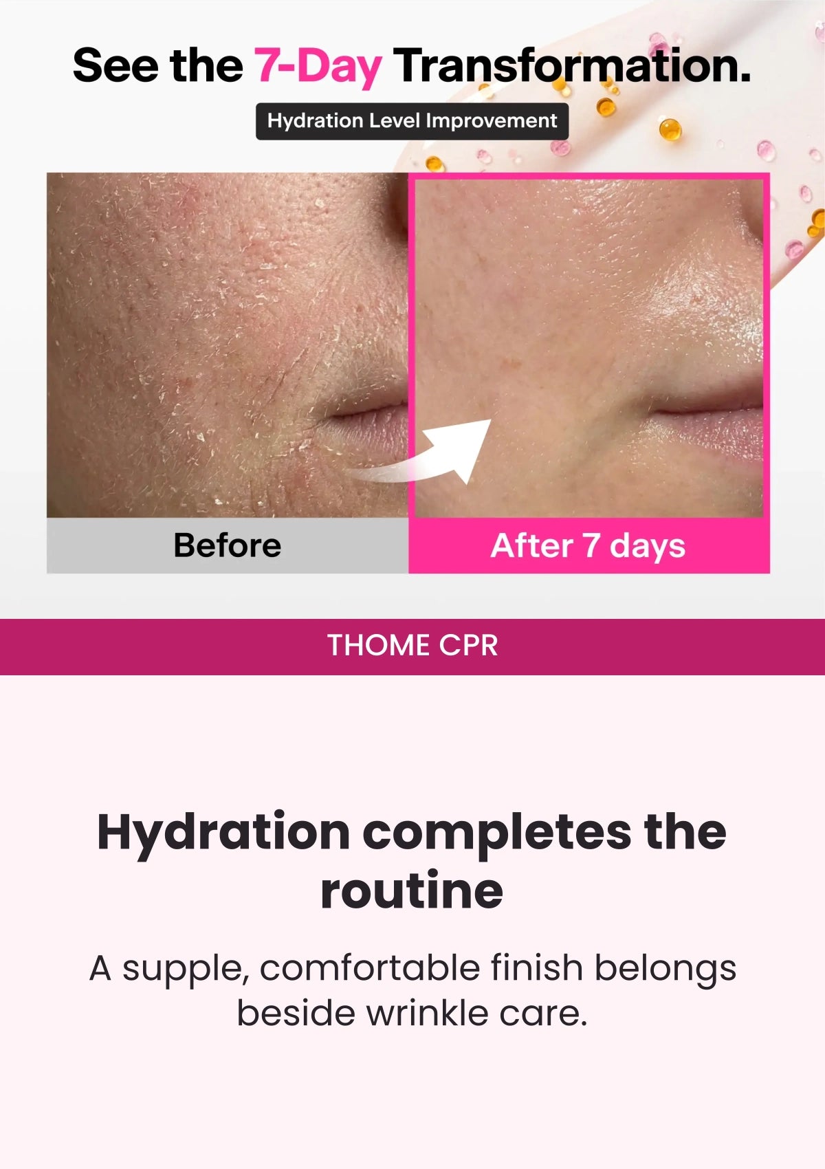 THOME CPR — Seven-day hydration transformation