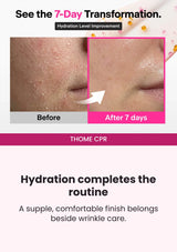 THOME CPR — Seven-day hydration transformation