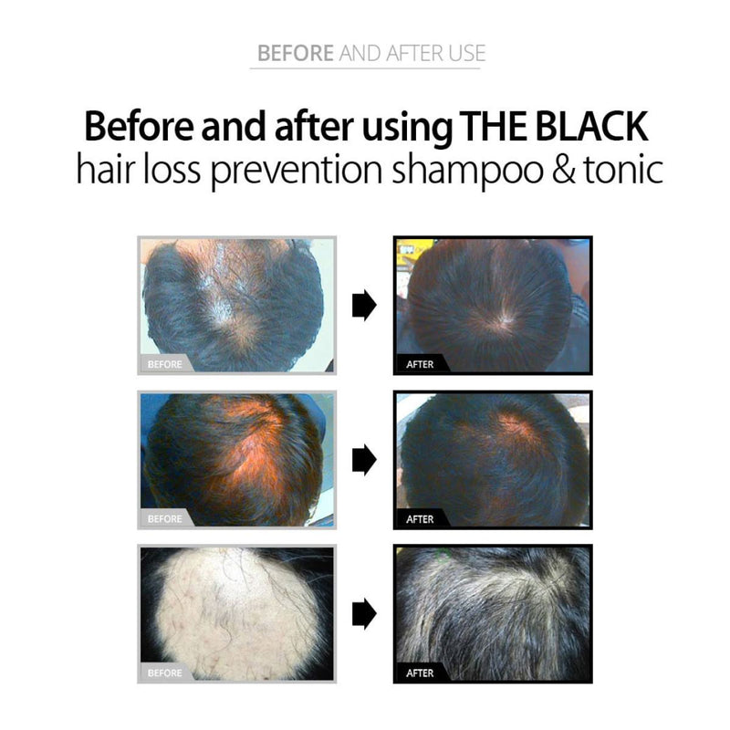 [THE BLACK] Hair boosting Shampoo 250ml/750ml & Hair Tonic 120ml + [Avocamo] Mask /Essence - COCOMO
