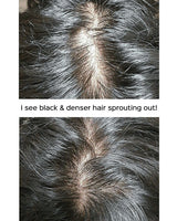 [MBA] Derma Scalp Black Turn Hair Shampoo 500ml - COCOMO
