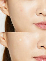 [COSRX] Set of 4 Acne Pimple Master Patch (24 X 4ea) - COCOMO